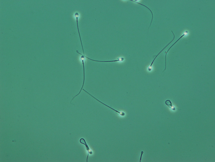 Human sperm under a microscope
